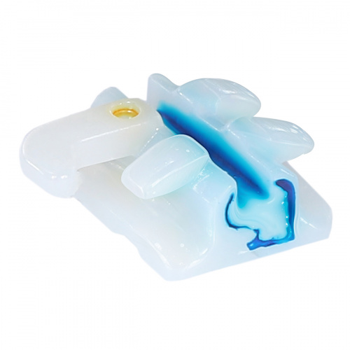 Брекеты COBY STR-U3L-022H из диоксида циркония,верхние левые на 3 зуб,паз.022",с крючком,ROTH от Атридент фото 6