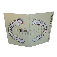 Таблица областей применения цветокодированных кюрет Грейси, YDM (Япония)