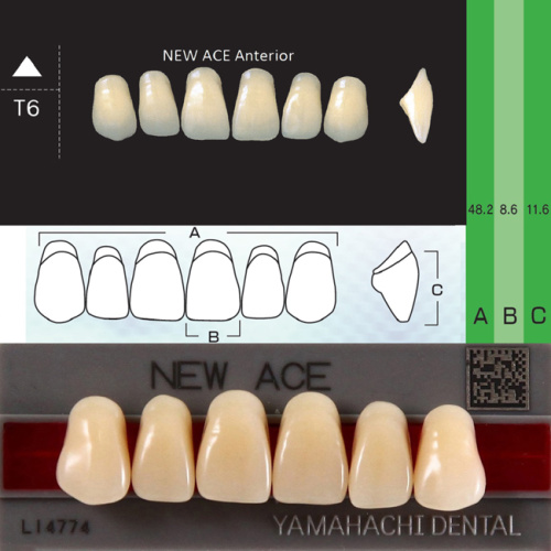 Зубы NEW ACE Anterior, цвет A1, фасон T6 акриловые двухслойные, 6 шт. от Атридент