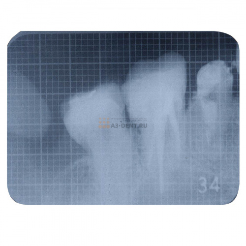 Линейка для рентгеновских снимков X-Ray Gauge фото 4