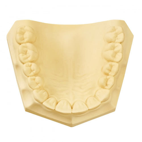 Гипс DENTAL STONE класс 3, цвет жёлтый, 18кг. от Атридент фото 2